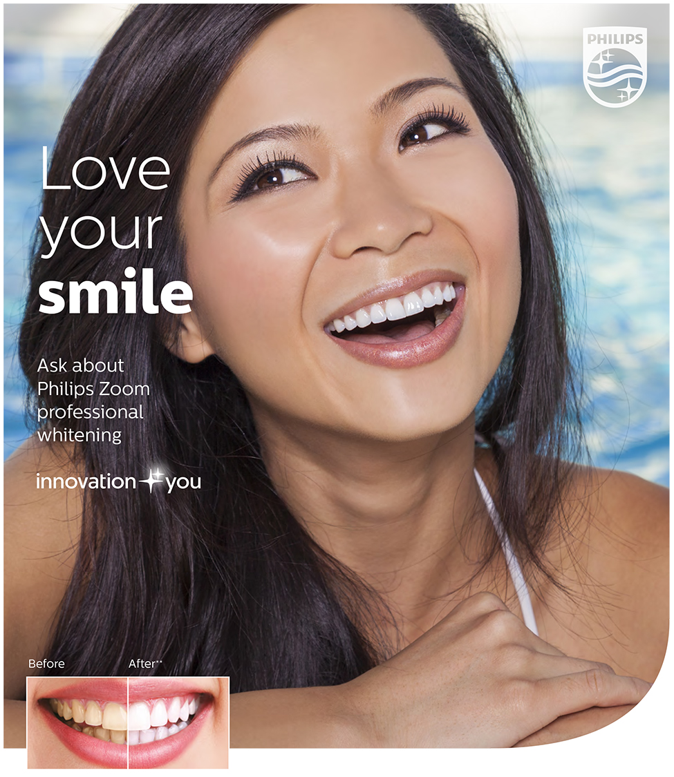 ZOOM-teeth-whitening1
