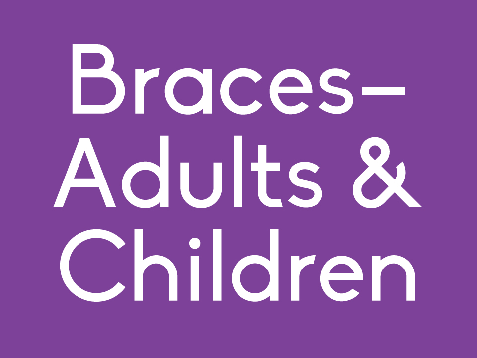 RxSmile braces for adults