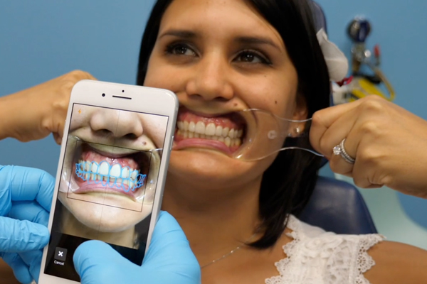 RxSmile Orthodontics Invisalign 3