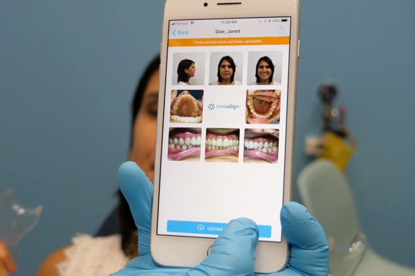 RxSmile Orthodontics Invisalign virtual