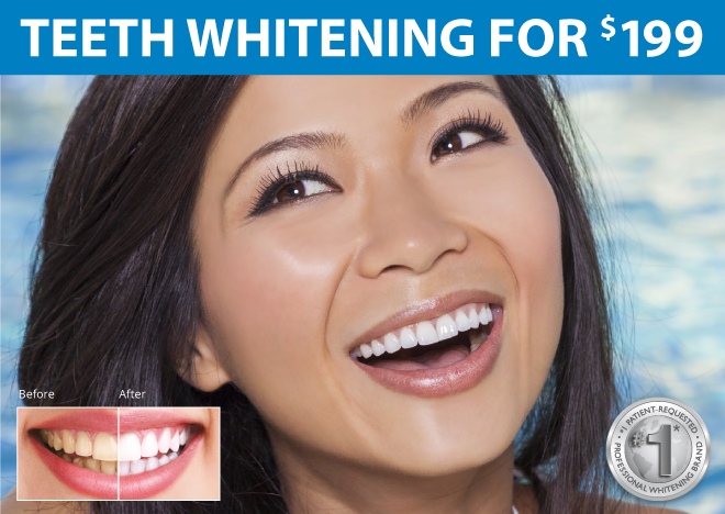 RxSmile Teeth Whitening fb