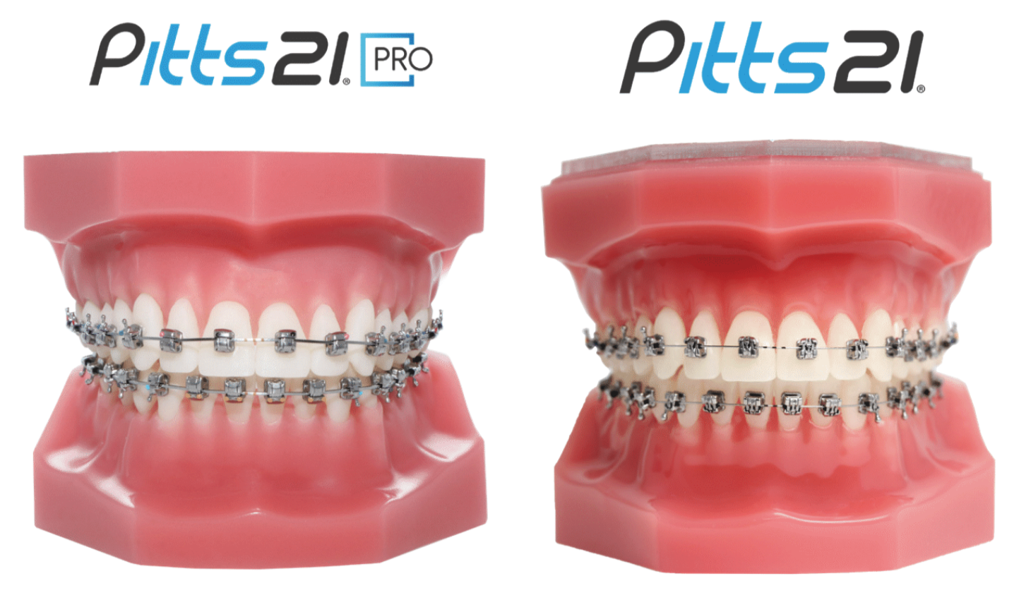 RxSmile Frisco Orthodontist uses Pitts21 self-ligating braces brackets