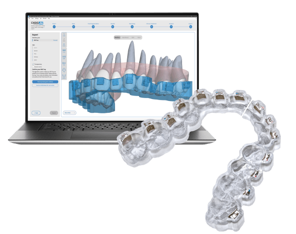 Orthoselect DIBS AI braces software Dr Greenberg uses to custom create patient's indirect bonding trays