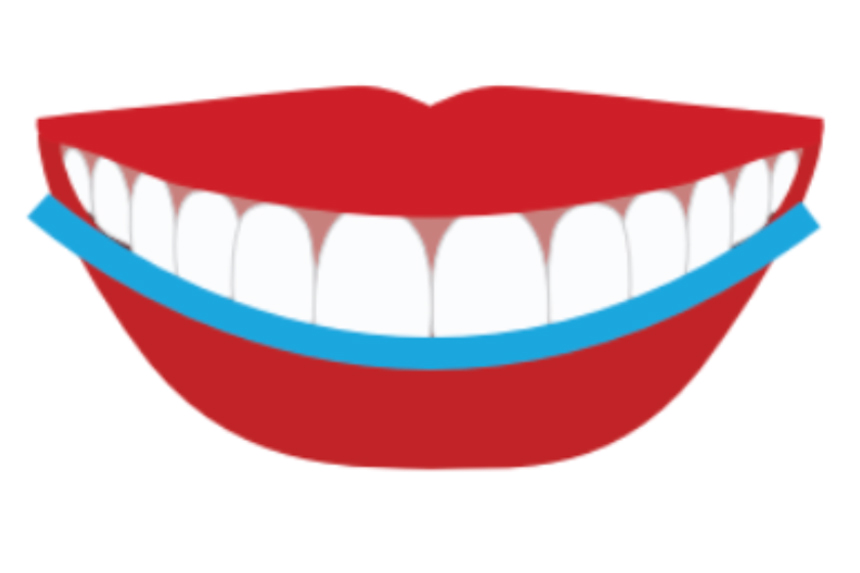 Natural-Smile-example