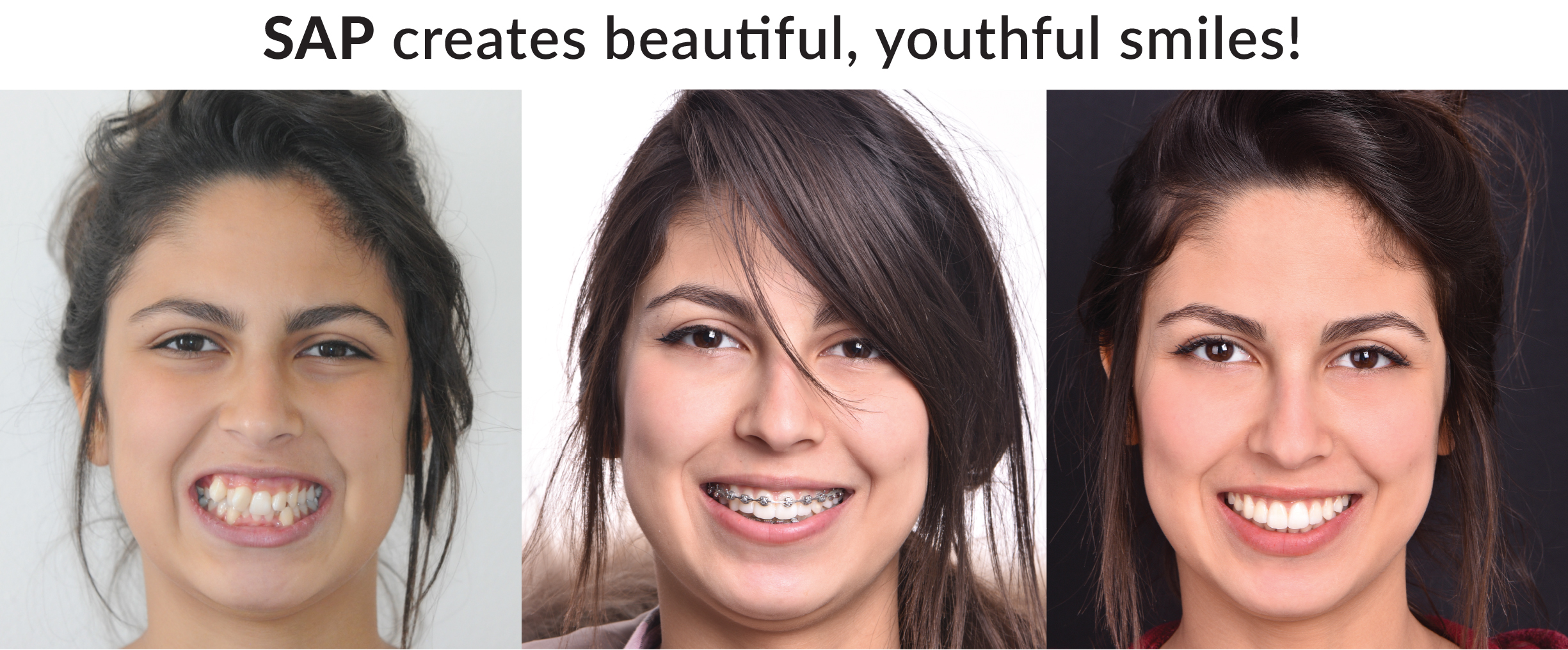 SAP Creates Beautiful Smiles SAP Creates Beautiful Smiles