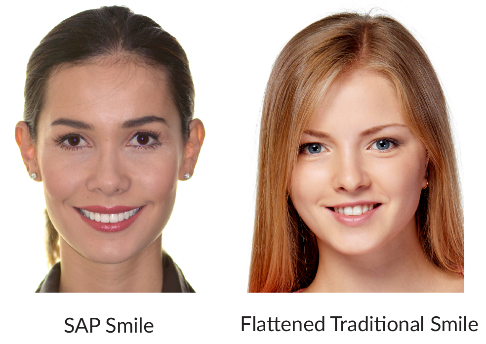 SAP Smile vs Traditional Smile SAP Smile vs Traditional Smile