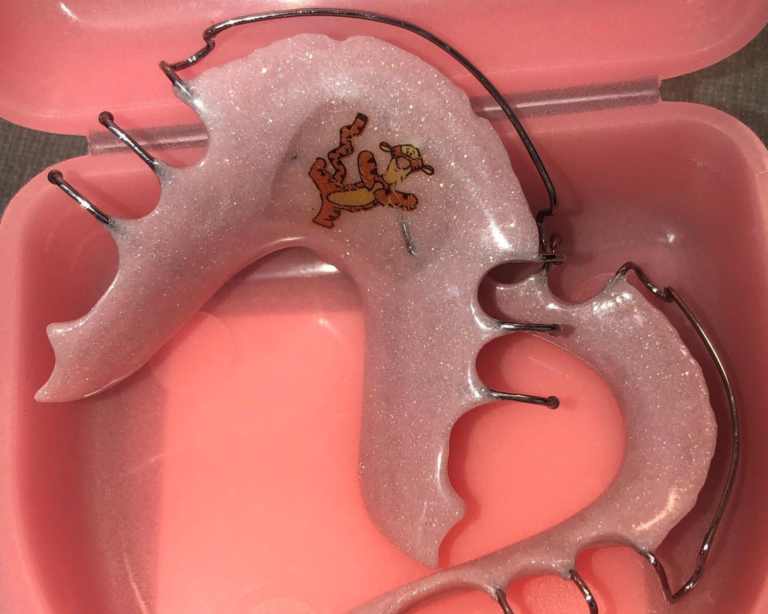 RxSmile Orthodontics can add a custom touch to your retainer