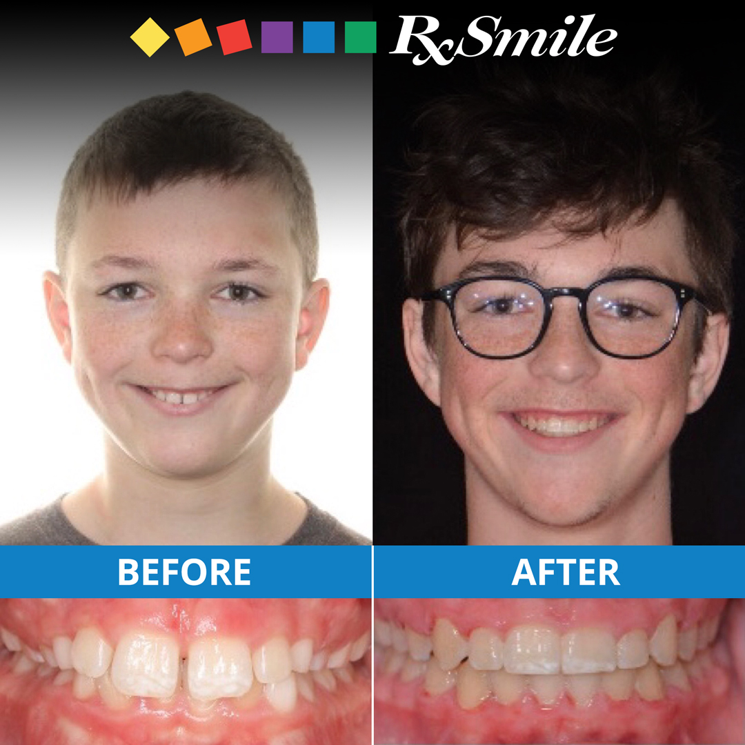 RxSmileTransformation3